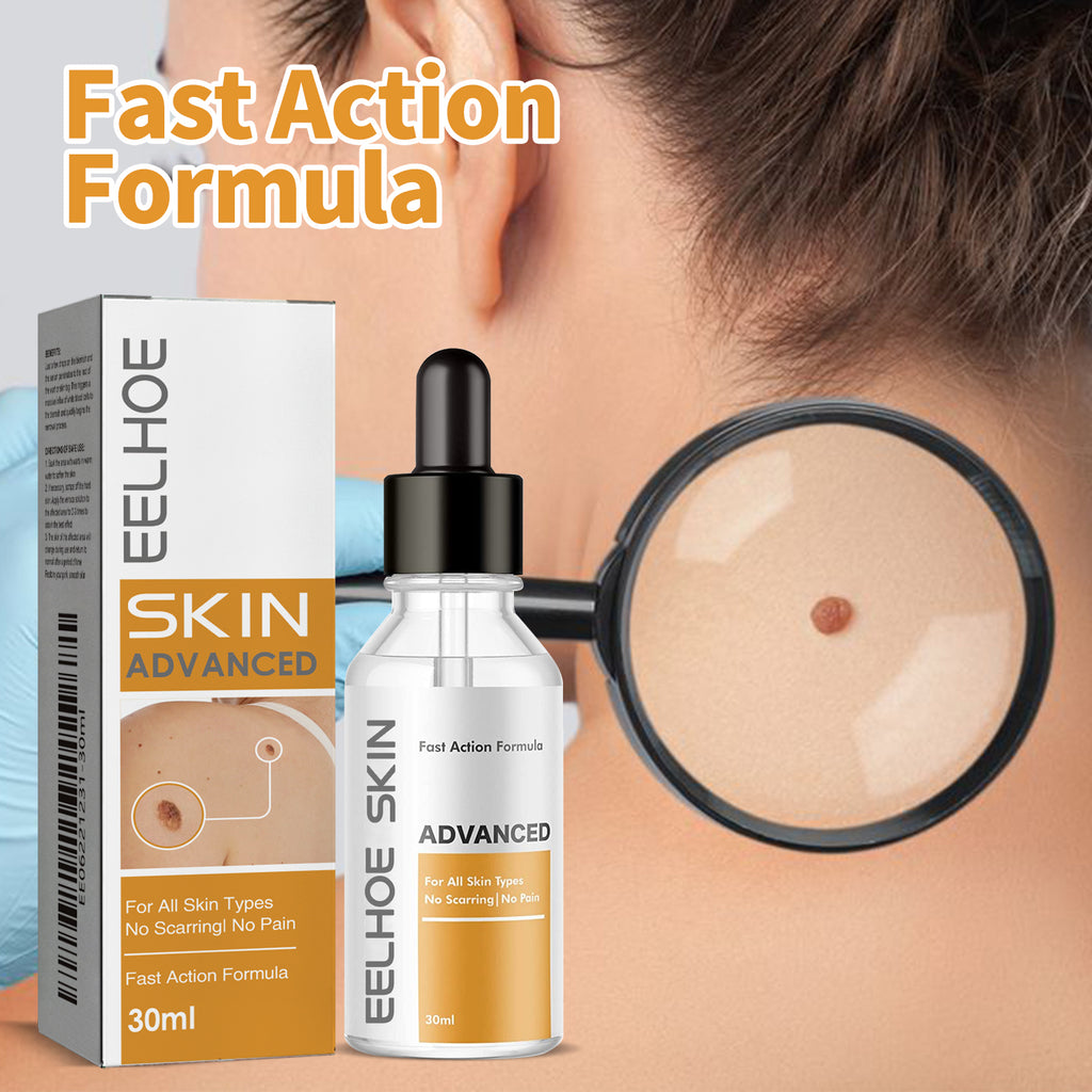EELHOE Anti-Wart Serum, Deep Cleansing Smooth Skin Fade Hand, Foot And Corns Wart Wart Serum